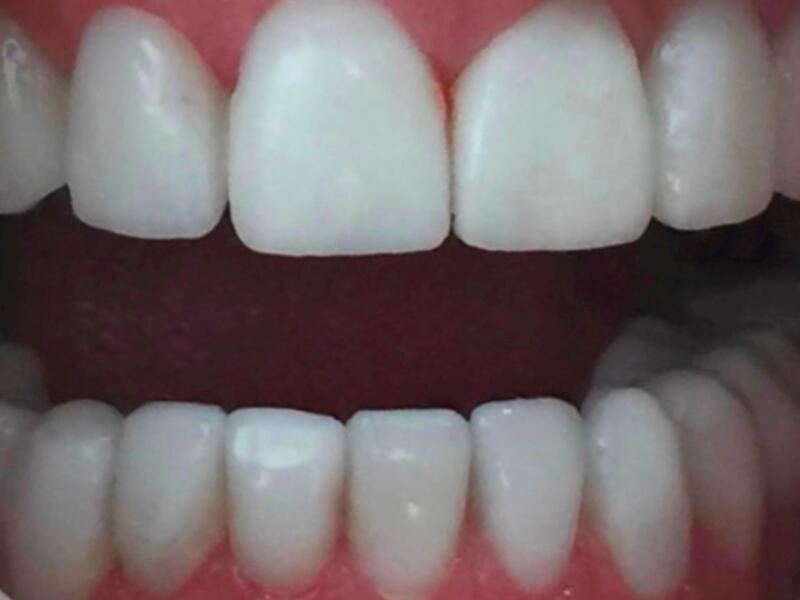 After image