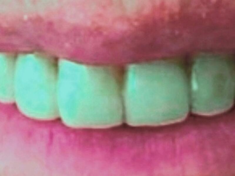 After image