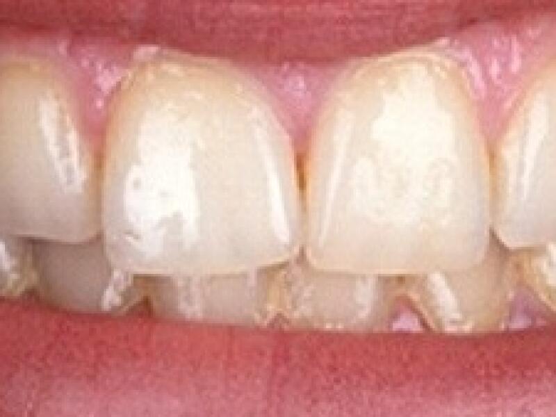 Before image