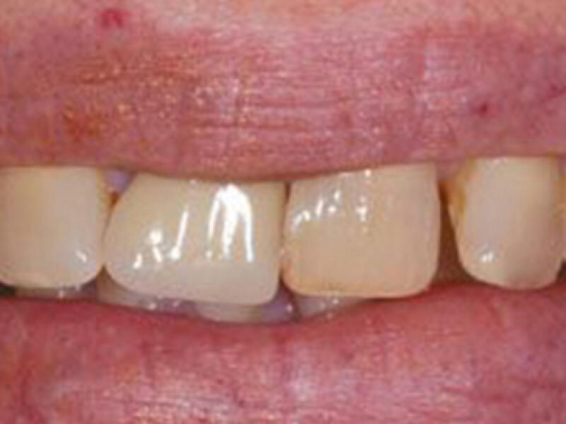 Before image
