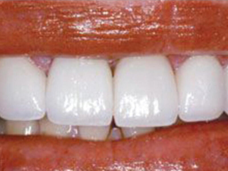 After image