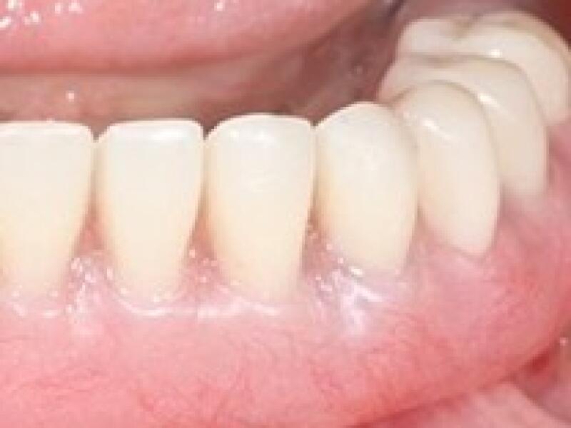 After image