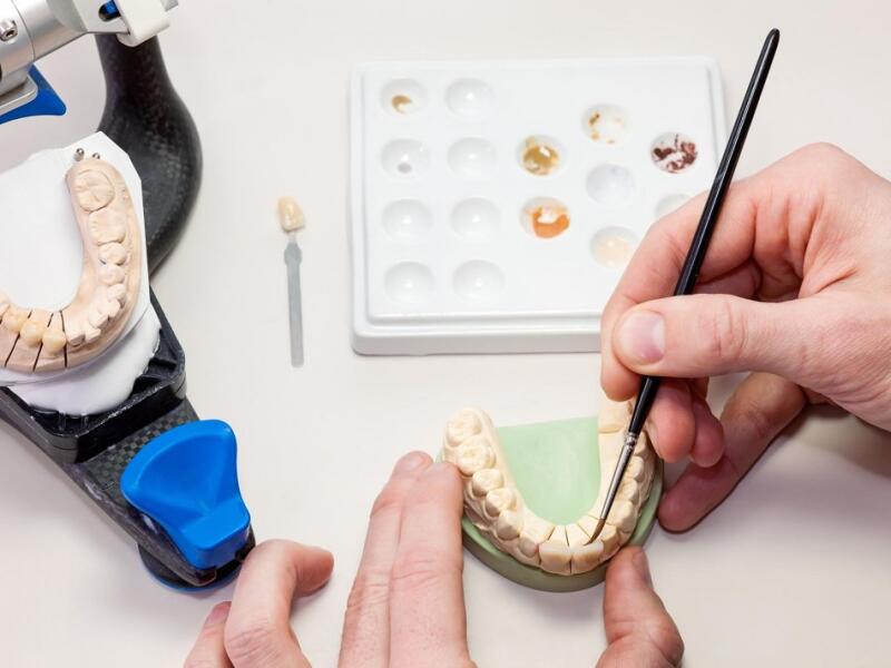 Notre laboratoire de prothèses dentaires à Javea